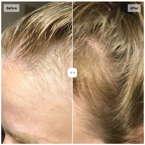 Zenagen Timeline for Effectiveness