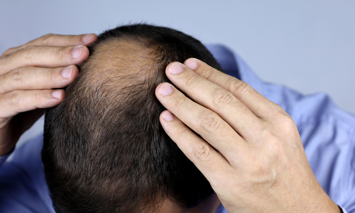 Using Locklab Before After Locklab vs Happy Head - Hair Kempt
