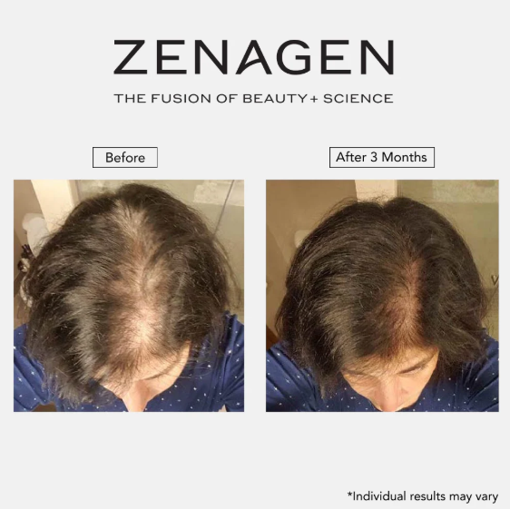 Zenagen Revolve Results