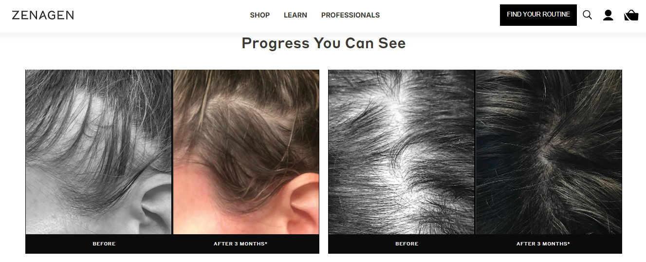 Zenagen before and after